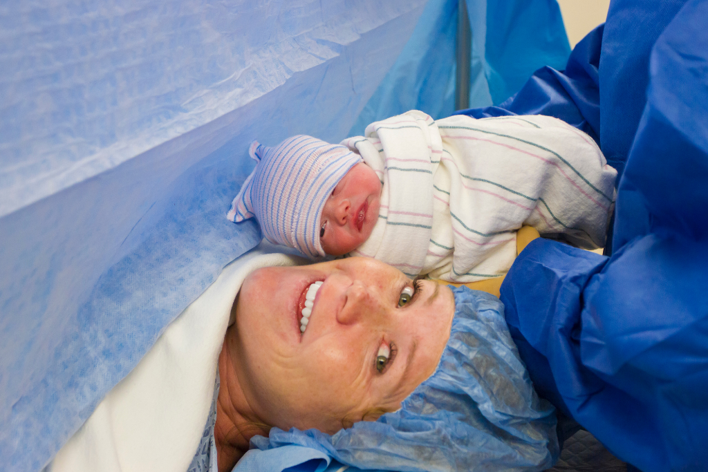 c section revision cost