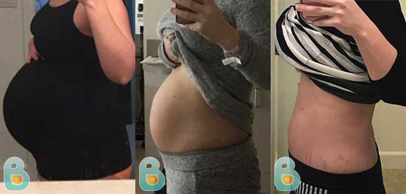 Bellefit Girdle CORSET Postpartum Belly Abdominal Wrap Size XL - READ 