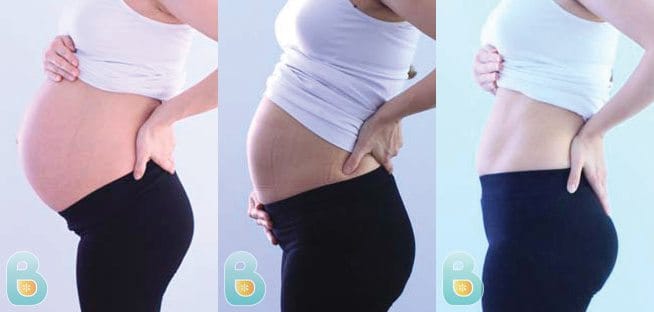 Postpartum Compression Leggings  Postnatal Maternity Support